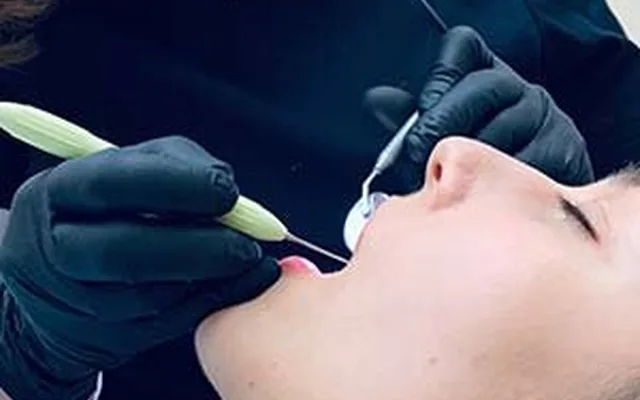 Microscopic root canal treatment