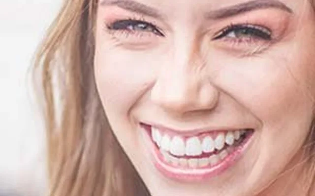 Professional teeth whitening